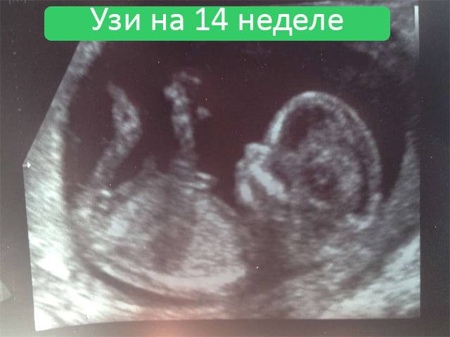 14 недель б. Пол плода на УЗИ 13 недель беременности. УЗИ плода на 14 неделе беременности пол ребенка. УЗИ 14 недель беременности пол мальчик.