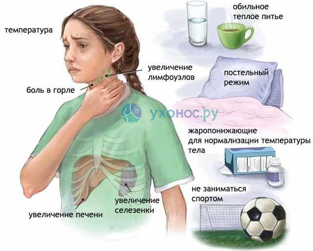 Ротавирусная инфекция (кишечный грипп): симптомы и лечение – напоправку