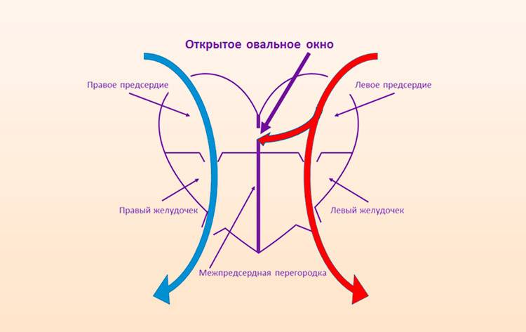 Увеличение печени: причины, симптомы, лечение | медицинский центр медлайн