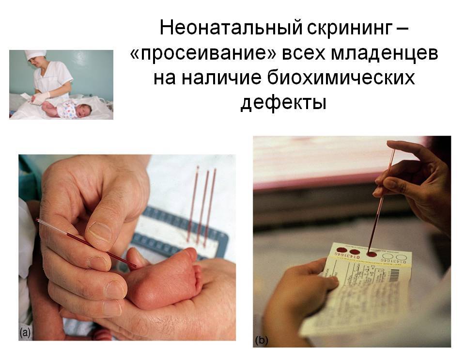 Отделение реанимации и интенсивной терапии новорожденных