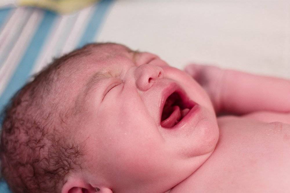 Дакриоцистит новорожденных - причины, диагностика и лечение