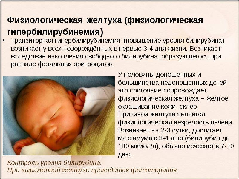Желтуха новорожденных - доказательная медицина для всех