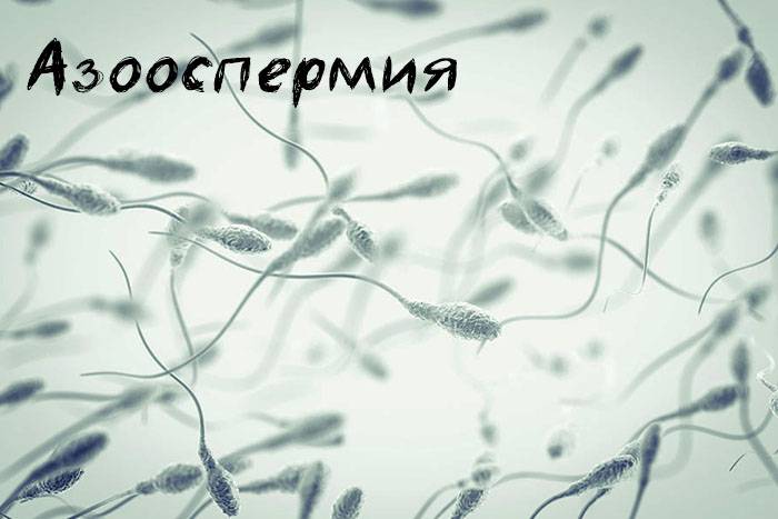 Аспермия - патология, выявляемая спермограммой