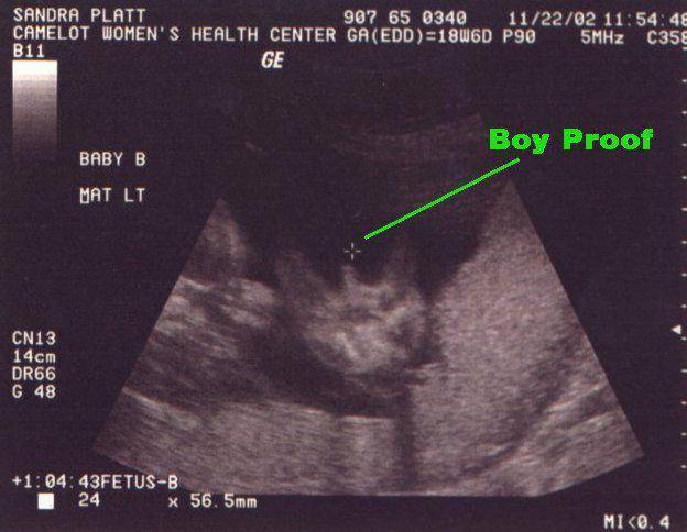 На каком сроке беременности можно узнать пол ребенка по узи