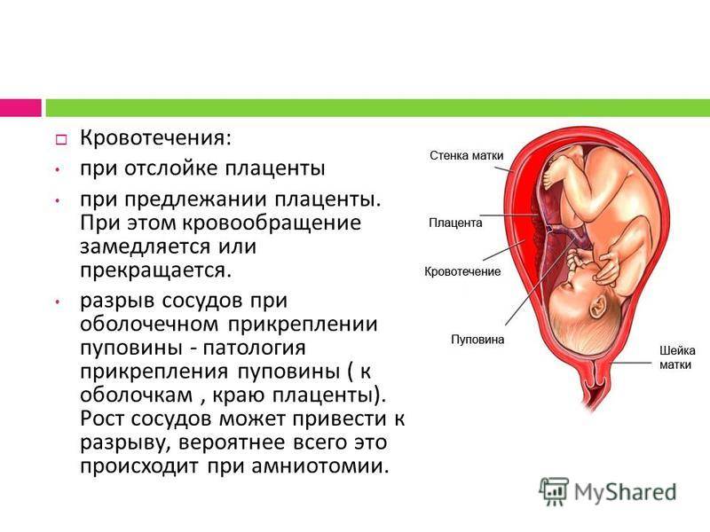 Автореферат и диссертация по медицине (14.01.01) на тему:течение и исходы беременности, осложнившейся отслойкой хориона