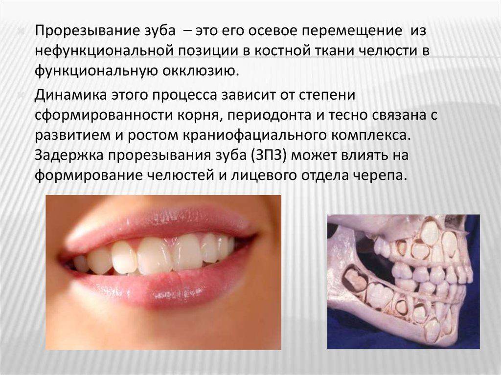 Ребенок родившийся с зубом что говорят парапсихологи. отвечаем на вопрос: почему ребенок родился с зубами. ребенок родился с зубами: причины, что делать, удаление, приметы