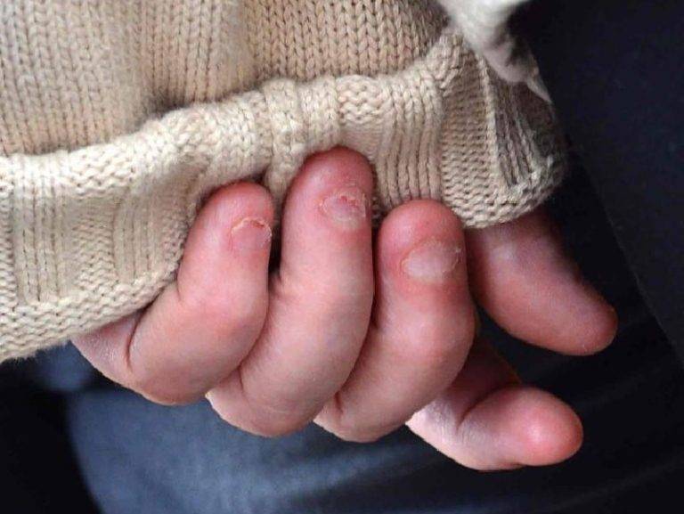Ребенок грызет ногти: что делать?