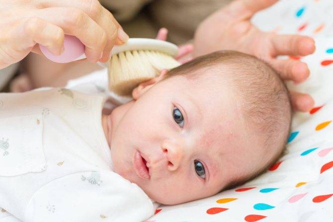 Себорейные корочки у младенцев: причины,  опасности и способы быстрого лечения