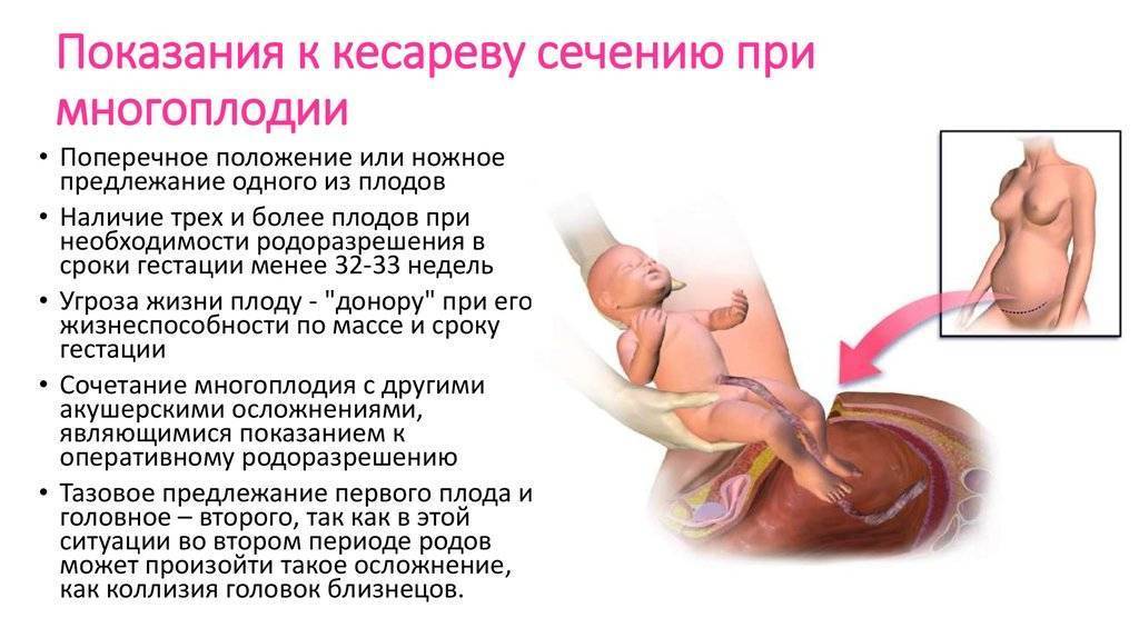 Беременность после кесарева: когда можно не опасаться за здоровье мамы и малыша