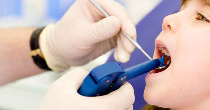 Фторирование зубов - полезные свойства фтора и как он защищает зубы