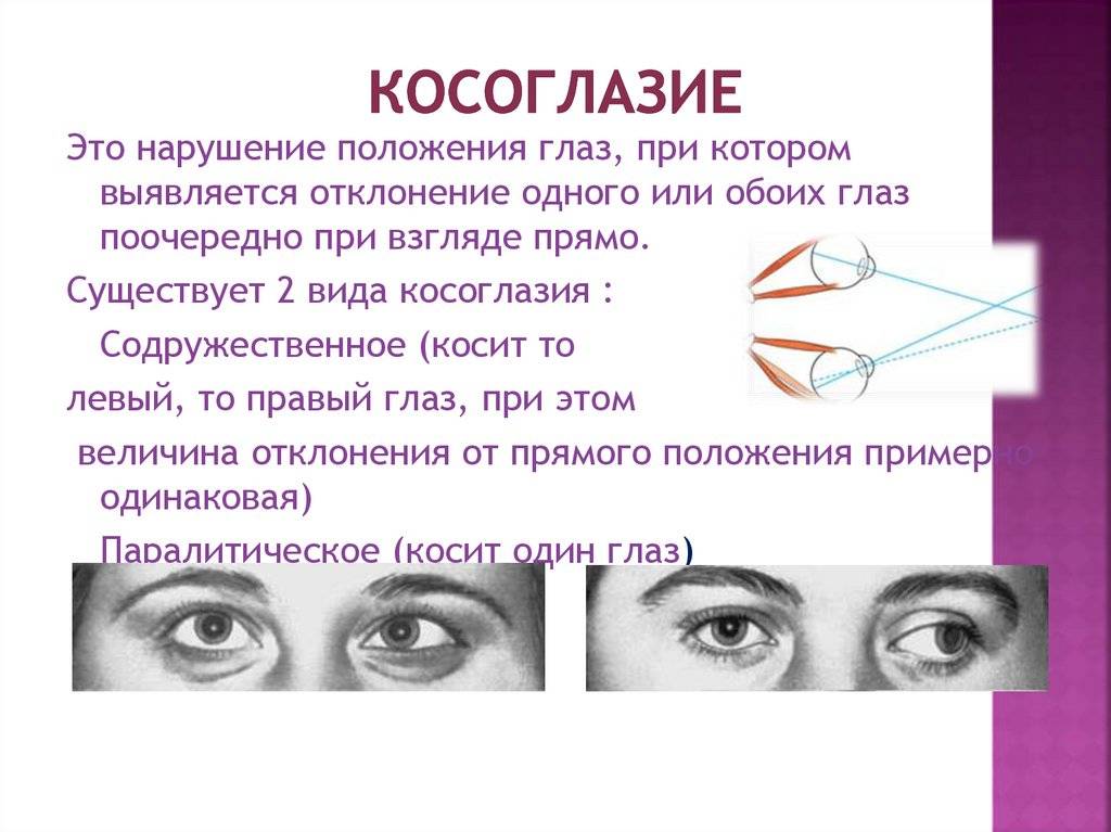 Как связаны патологии зрения и неврологические заболевания