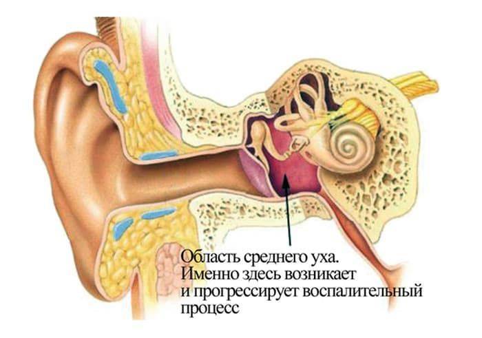 Ощущение заложенности в ушах: симптомы | компетентно о здоровье на ilive