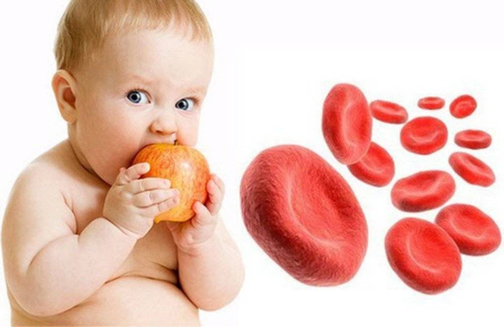 Железодефицит у младенцев и детей первого года жизни.