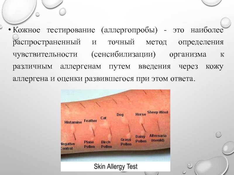 Диагностика аллергии | аллергология и иммунология