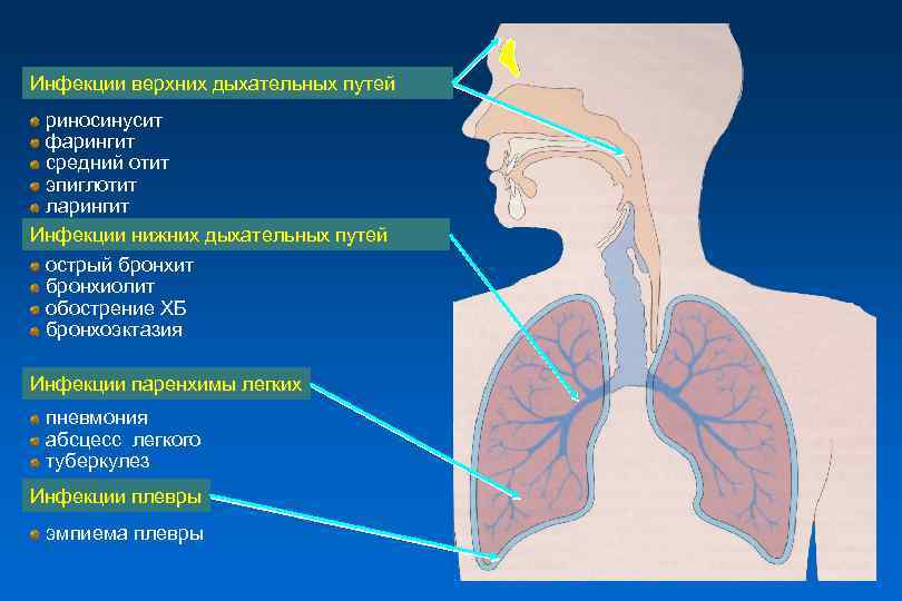 ➤ как лечить заболевания дыхательных путей и легких