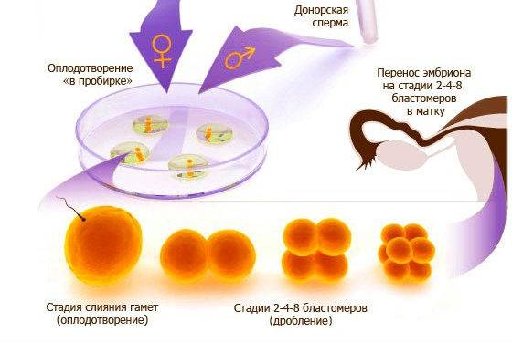 Заморозка яйцеклеток: как происходит?