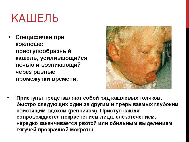 Лающий кашель у ребенка: причины и эффективные способы лечения