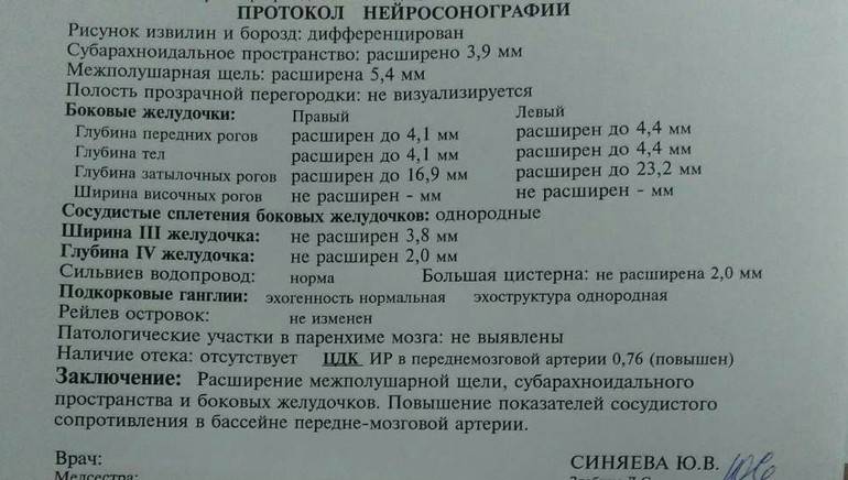 Нейросонография новорожденных - цены на услугу в москве.где сделать нейросонографию?