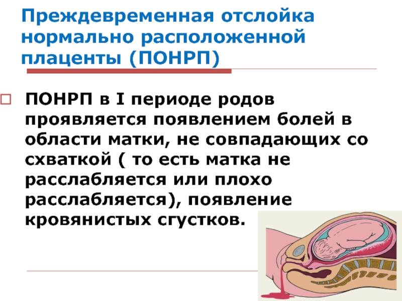 Профилактика отслойки плаценты — medcenter.online