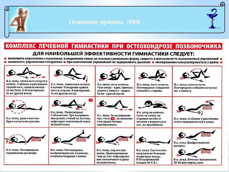 Схема лечения остеохондроза