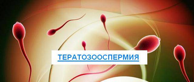 Тератозооспермия: выявление, причины, методы лечения