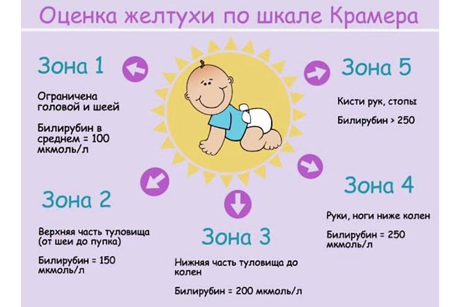 Желтуха новорожденных | симптомы | диагностика | лечение - docdoc.ru