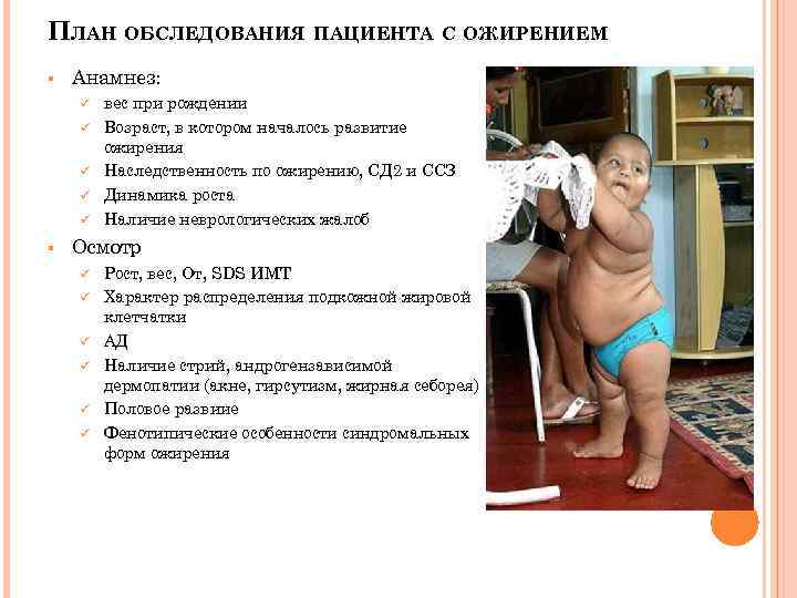 Ожирение у детей - симптомы болезни, профилактика и лечение ожирения у детей, причины заболевания и его диагностика на eurolab