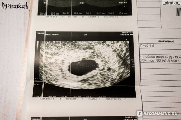 Что можно узнать на узи 6 недели во время беременности?
