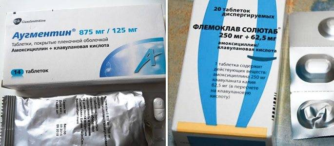 Антибиотики при ангине у детей