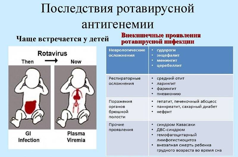 Ротавирусная инфекция у детей грудного возраста, дошкольного возраста и у взрослых. симптомы, диагностика и лечение ротавирусной инфекции :: polismed.com