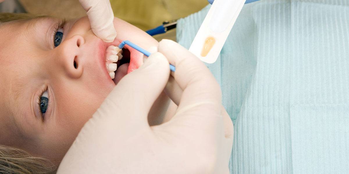 Как восстановить зубную эмаль - у стоматолога, в домашних условиях. укрепление эмали зубов