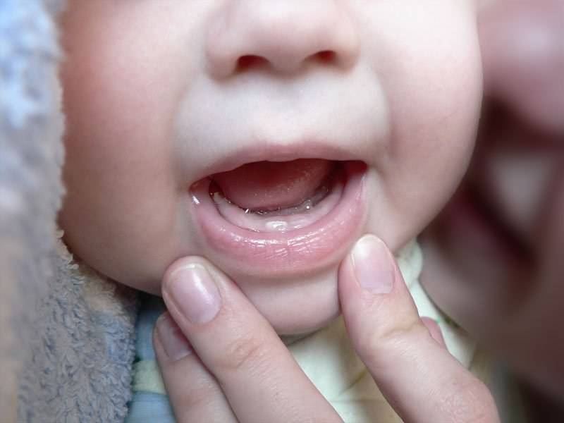 Гель при прорезывании зубов у младенцев