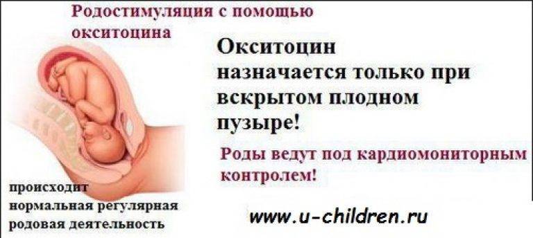 Обезболивание при родах: преимущества, техники и побочки - статья репродуктивного центра «за рождение»
