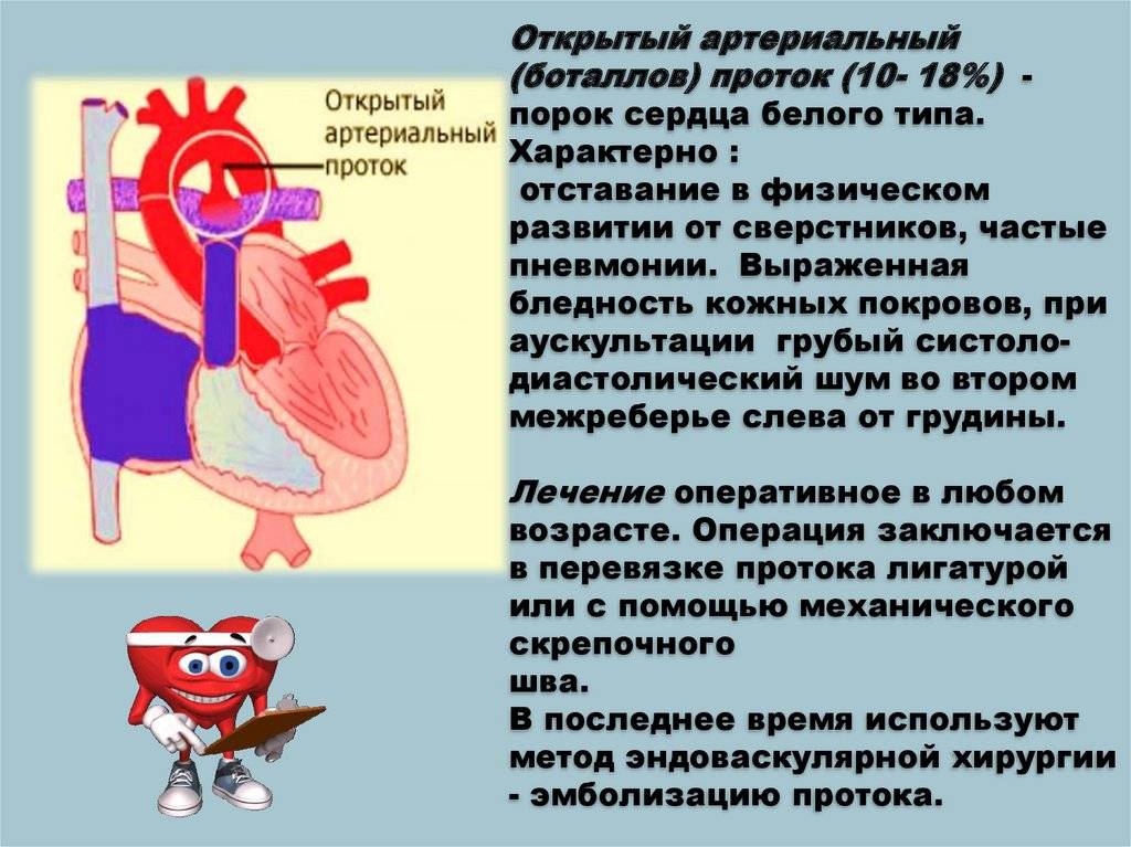 Врожденные пороки сердца (открытый артериальный проток, тетрада фалло, коарктация аорты, дефект межжелудочковой перегородки) - причины, диагностика и лечение