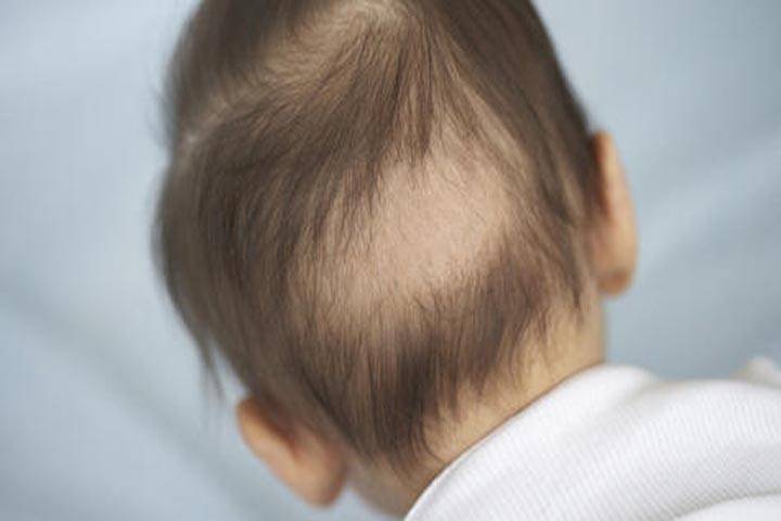 Выпадают волосы у грудничка: причины и их устранение