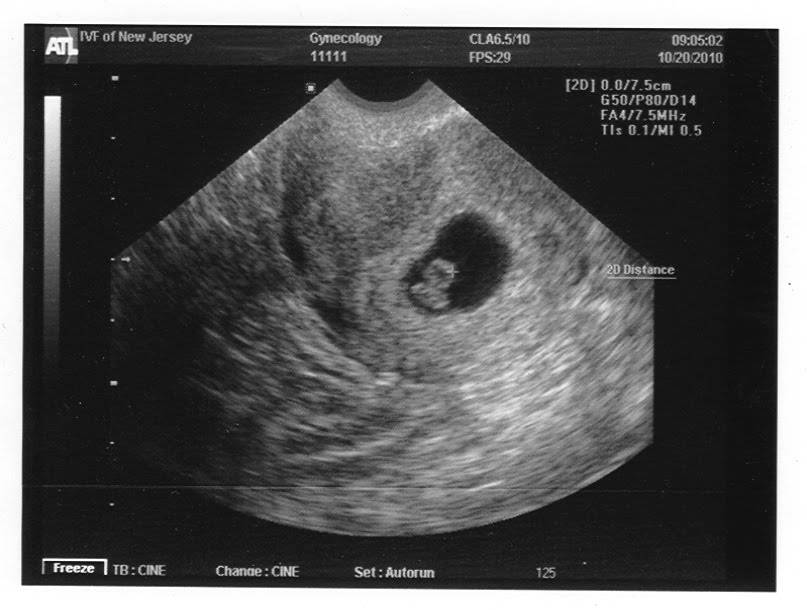 Беременность: 8 неделя | компетентно о здоровье на ilive
