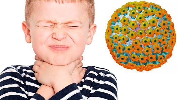 Инфекционный мононуклеоз у детей | симптомы и лечение инфекционного мононуклеоза у детей | компетентно о здоровье на ilive