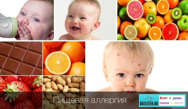 Пищевая непереносимость у детей
