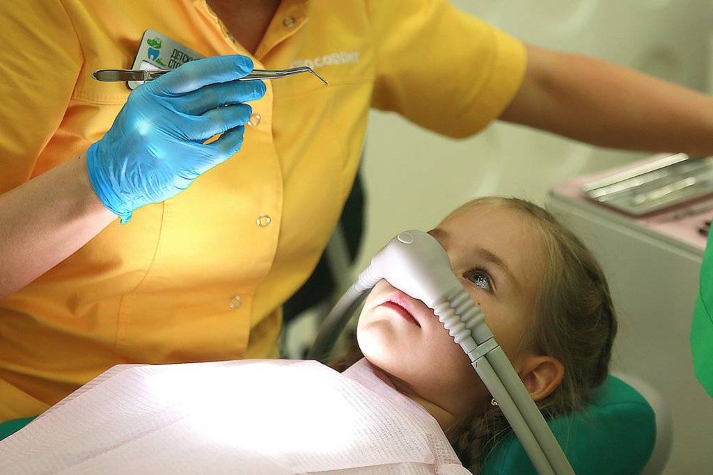 Лечение зубов с применением закиси азота