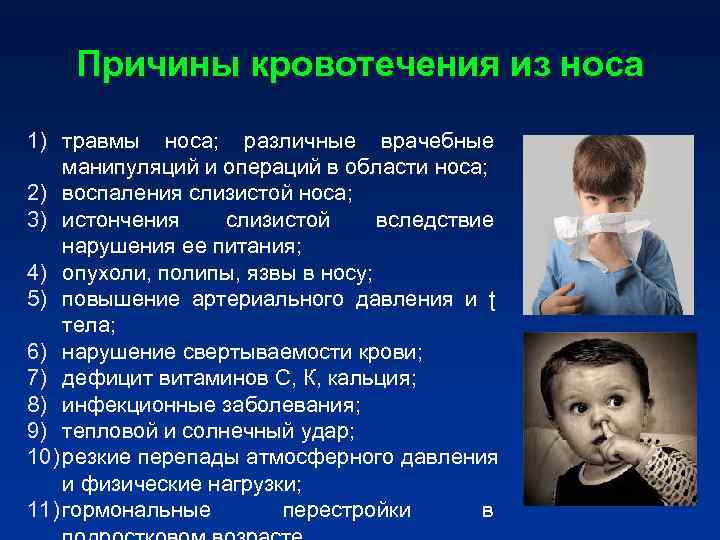 Аденоиды в носу у детей: симптомы и лечение аденоидов у ребенка, что делать при аденоме комплексное лечение без операции