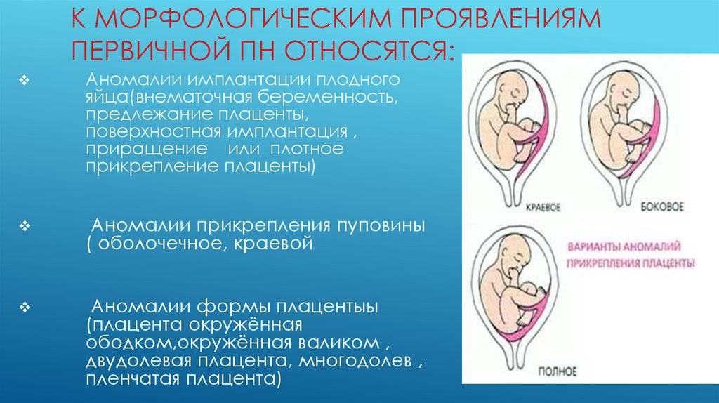 Плацента: строение, функции, зрелость, гиперплазия, предлежание, отслойка   | материнство - беременность, роды, питание, воспитание