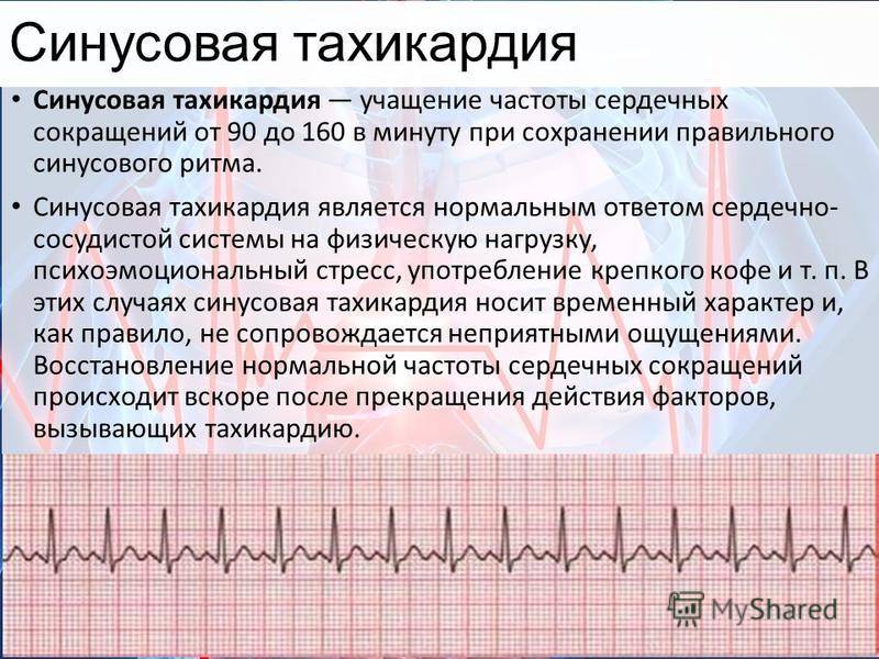Нарушения сердечного ритма | кардиологический центр в санкт-петербурге
