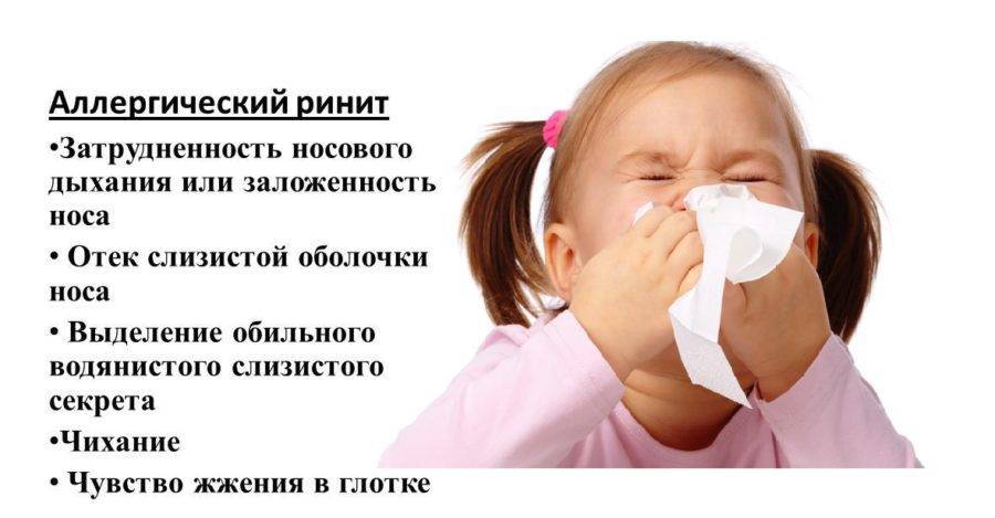 Аллергический ринит симптомы у детей и взрослых