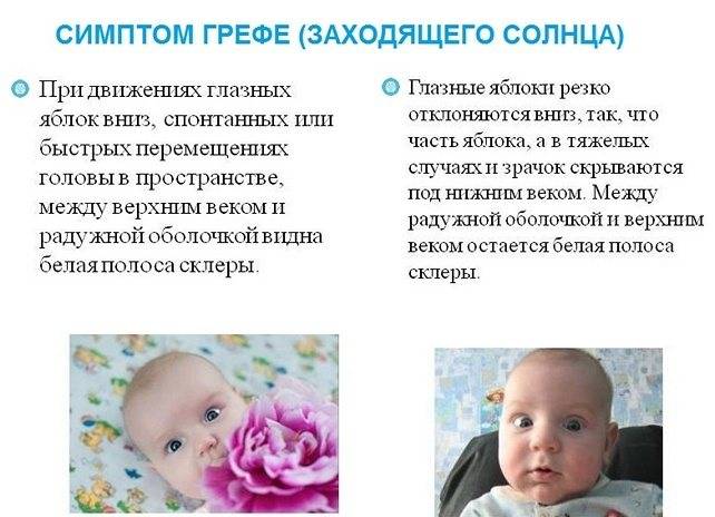 Дефицит внимания у детей: лечение, чем обусловлен синдром гиперактивности у ребенка, причины и симптомы сдвг