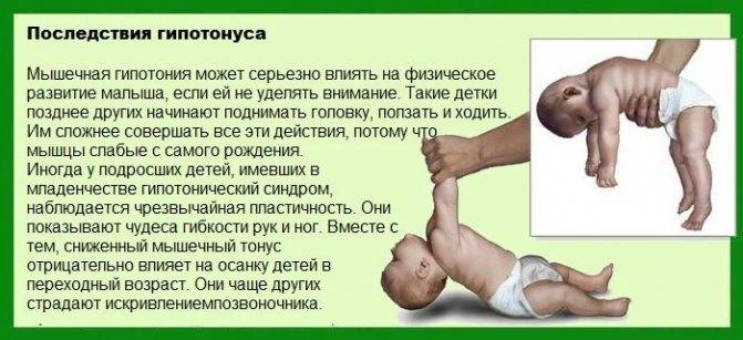 Тонус мышц у младенцев. причины возникновения и методы лечения - beautyvertebro.com