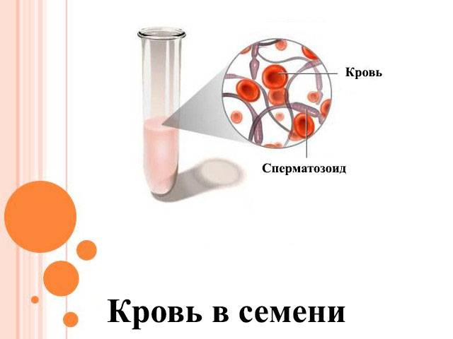 Как улучшить показатели спермограммы. какие факторы ухудшают сперматогенез. какие факторы способны улучшить сперматогенез. антиоксиданты и их роль в мужском бесплодии. какие витамины, аминокислоты  и микроэлементы используют для улучшения сперматогенеза.