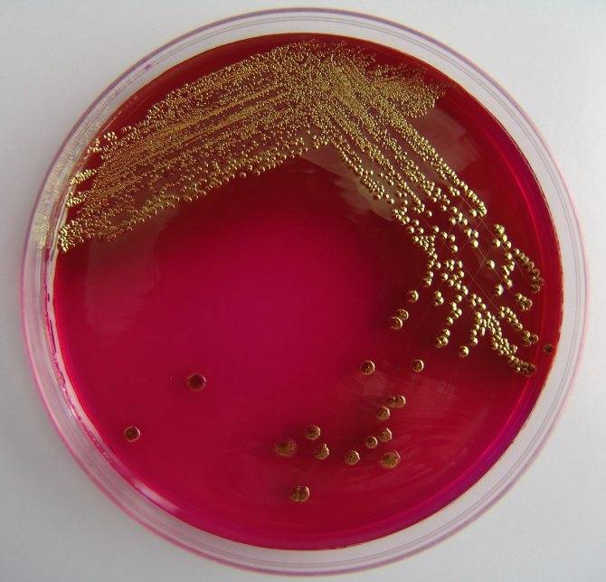 Инфекции мочевых путей. бессимптомная бактериурия, неосложнённые цистит и пиелонефрит