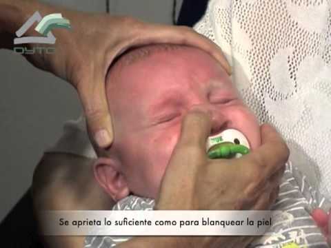 Как делать массаж слёзного канала у новорождённых oculistic.ru
как делать массаж слёзного канала у новорождённых