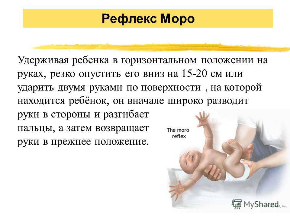 Рефлекс Моро у новорожденных