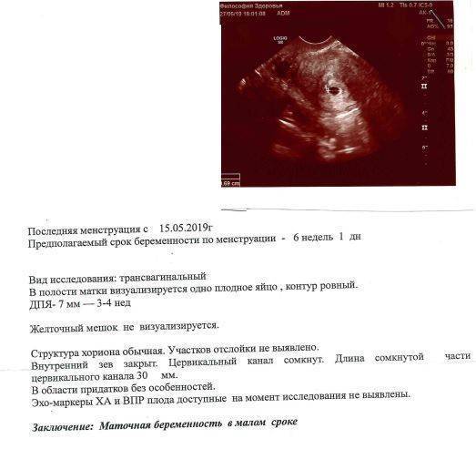 Беременность 5-6 недель. первые признаки, развитие малыша. узи. размеры плодного яйца